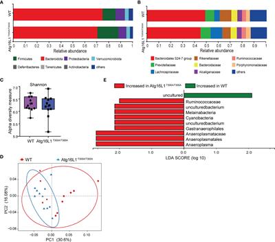 IBD-Associated Atg16L1T300A Polymorphism Regulates Commensal Microbiota of the Intestine